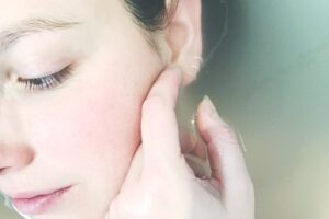 Microdermabrasion