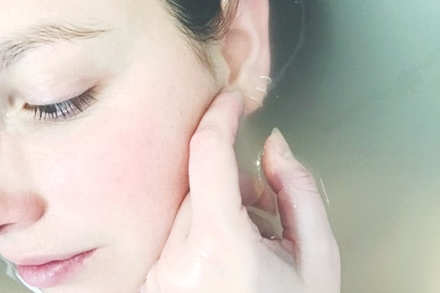 Microdermabrasion